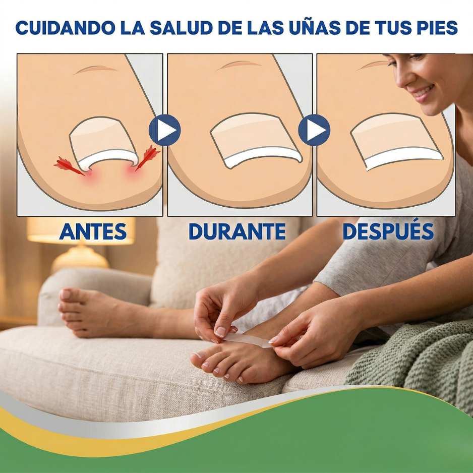 NailFix Pro™ — Corrector Invisible de Uñas Encarnadas, Alivio Inmediato y Resultados Visibles en Días