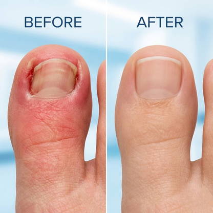 NailFix Pro™ — Corrector Invisible de Uñas Encarnadas, Alivio Inmediato y Resultados Visibles en Días